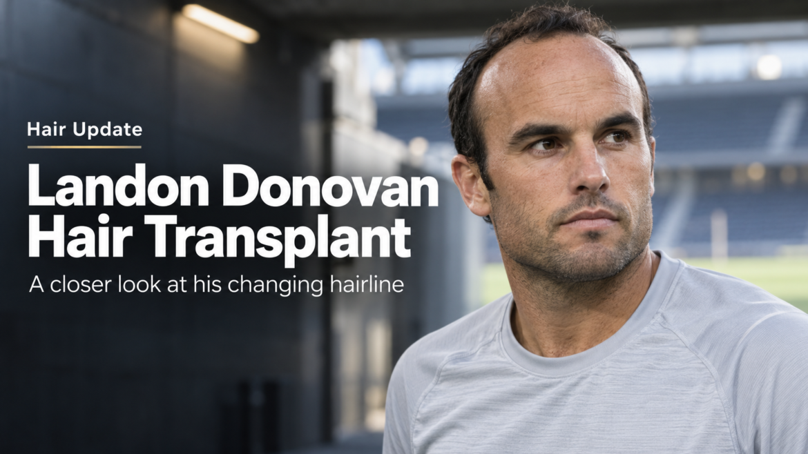 Landon Donovan hair transplant featured image showing the former football player in a stadium setting.